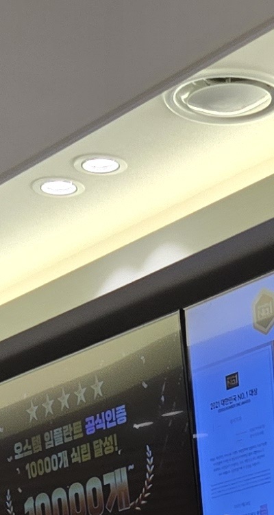 임플란트 뼈이식 안하면 어떤 문제가 있는거죠 관련 이미지 17