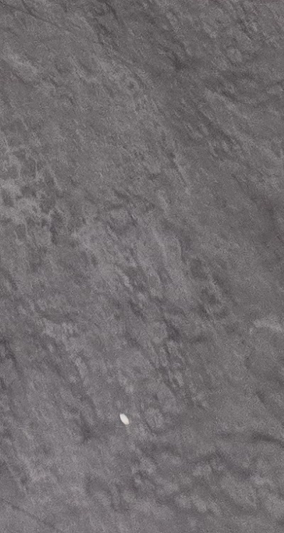 어금니 임플란트 안하면 후회하게 되는걸까 관련 이미지 51