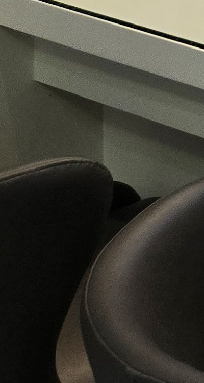 아래 사랑니 발치 통증 미리 알고 대처하려면 관련 이미지 40