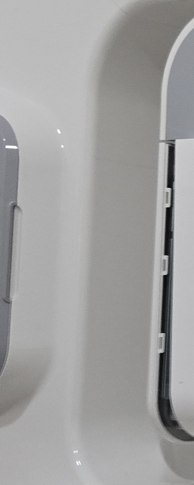 인레이 치료 후 신경치료 이유가 궁금하다면 관련 이미지 25