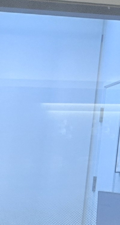 인레이 치료 후 통증 자꾸 심해지는데 괜찮은걸까 관련 이미지 32