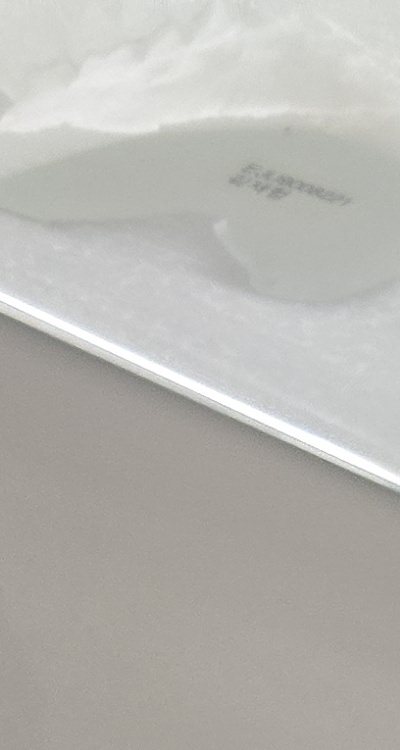 앞니 틀어짐 부분교정 얼마나 걸릴까 관련 이미지 16