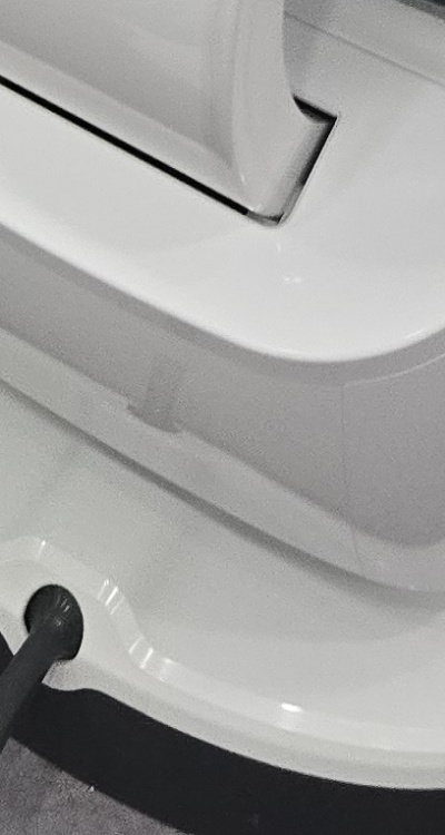 어금니 임플란트 안하면 후회하게 되는걸까 관련 이미지 48