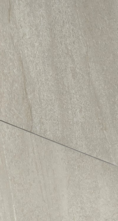 임플란트의 장점 할까 말까 고민이신 분들을 위한 정리 관련 이미지 14