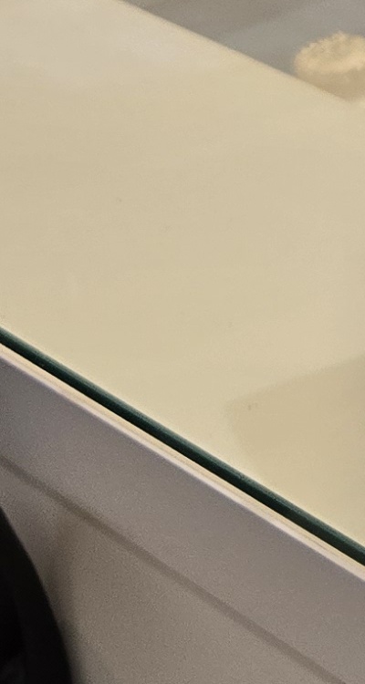 신경치료 아픈가요 망설이시는 분들이라면 관련 이미지 33