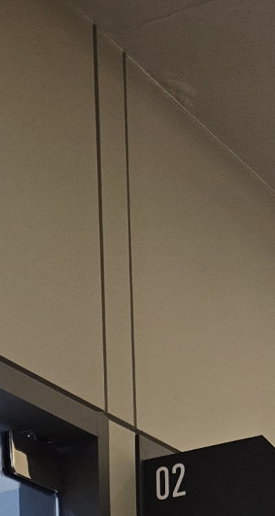 아말감 교체 레진 인레이 어떻게 대처하면 될까 관련 이미지 17