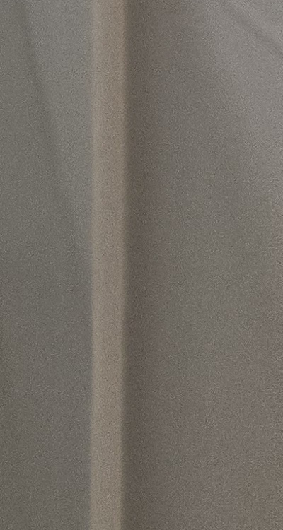 앞니 틀어짐 부분교정 얼마나 걸릴까 관련 이미지 40