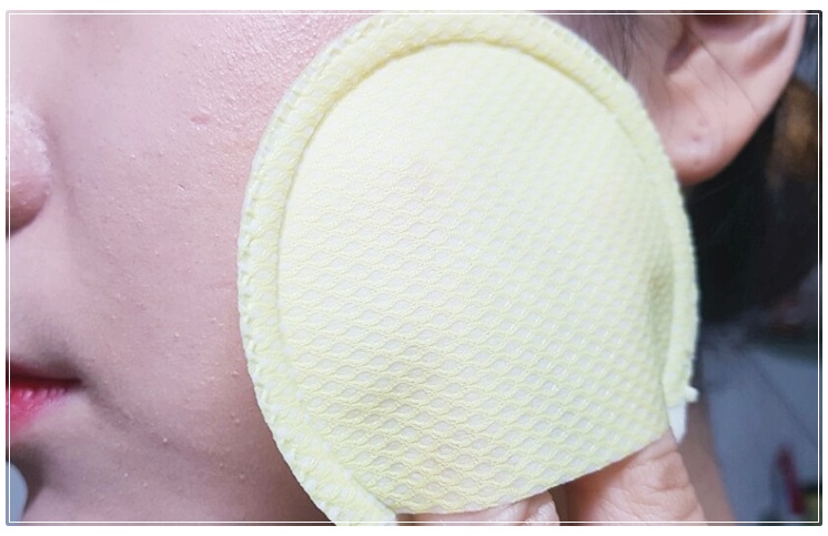 블랙헤드없애는법 더 강력하게 돌아왔다 관련 이미지 6