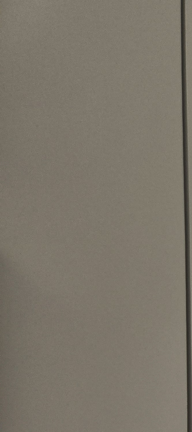 앞니 틀어짐 교정 방법 이럴때는 좀더 간단해요 관련 이미지 21