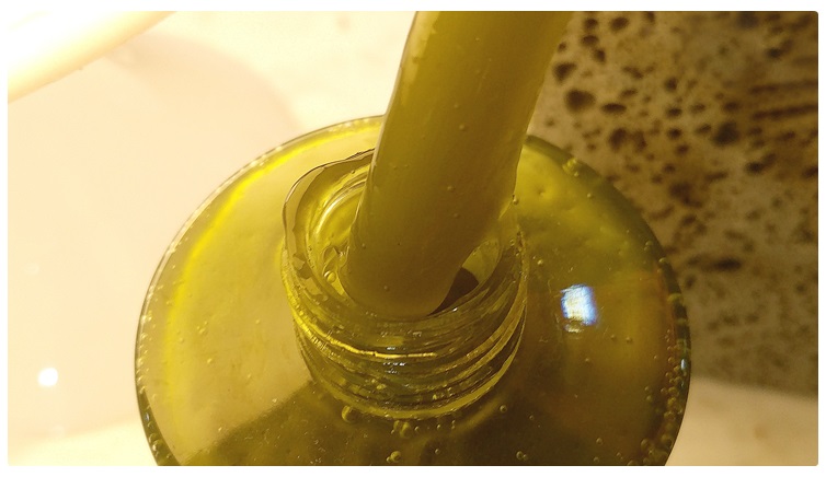 화이트헤드 제거 꿀팁공개! 관련 이미지 4