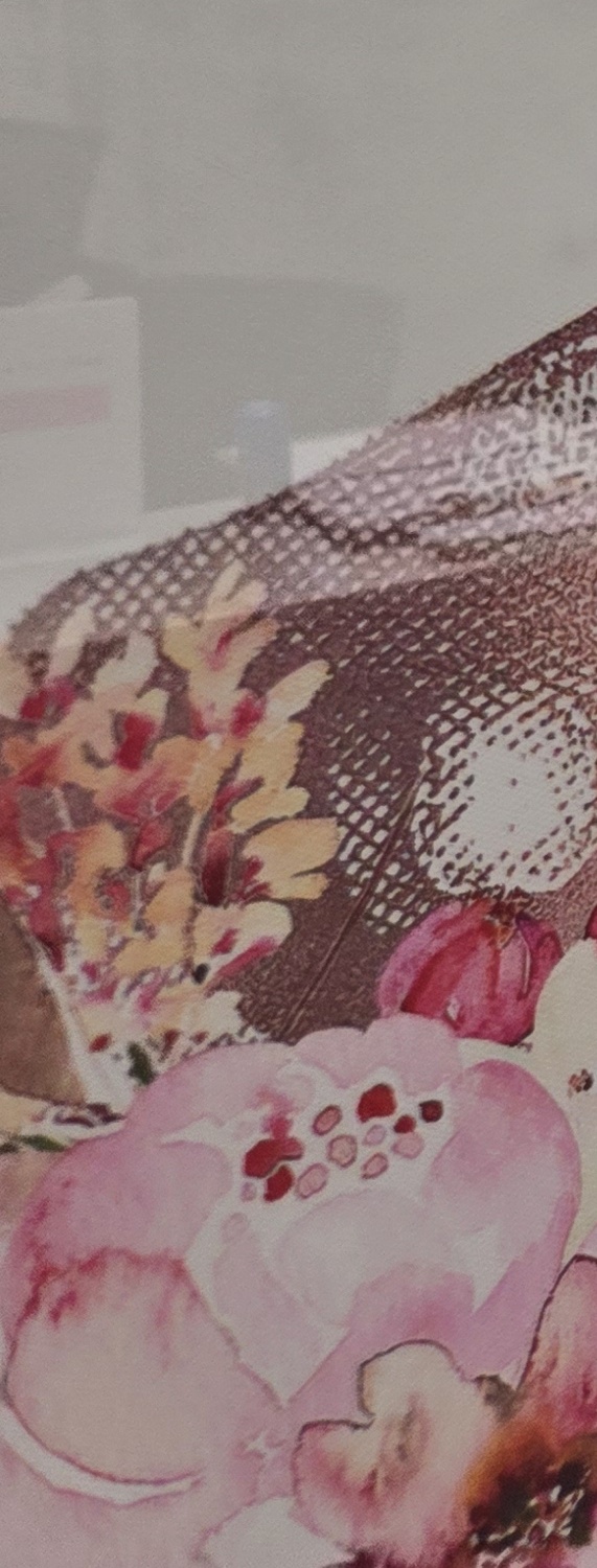 충치 치아 깨짐 시점이 관건이라면 관련 이미지 18