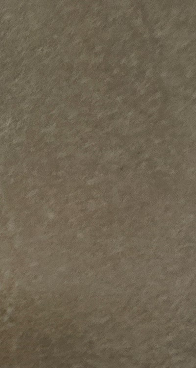 반대교합 치아교정 해결 가능할까 관련 이미지 16