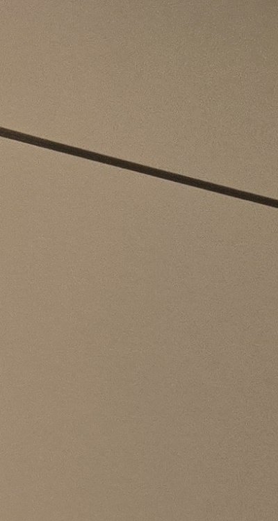 사랑니 발치 후 충치 치료 둘다 준비하려면 관련 이미지 16