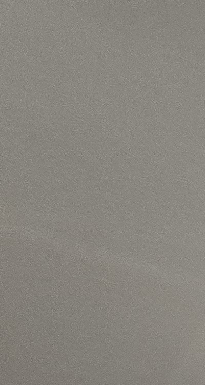 앞니 틀어짐 부분교정 얼마나 걸릴까 관련 이미지 12