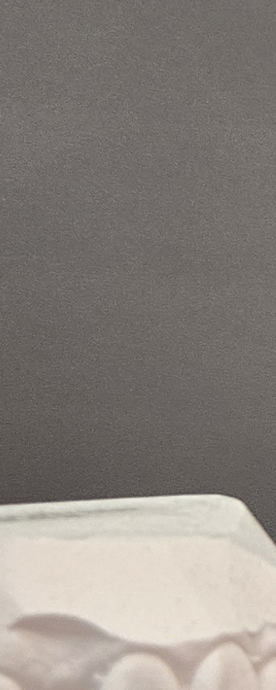 어르신 임플란트 지원 현명하게 활용하려면 관련 이미지 24