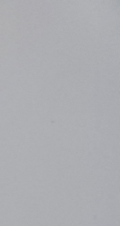 앞니 부분 교정 간단하니까 좋은건가요 관련 이미지 22