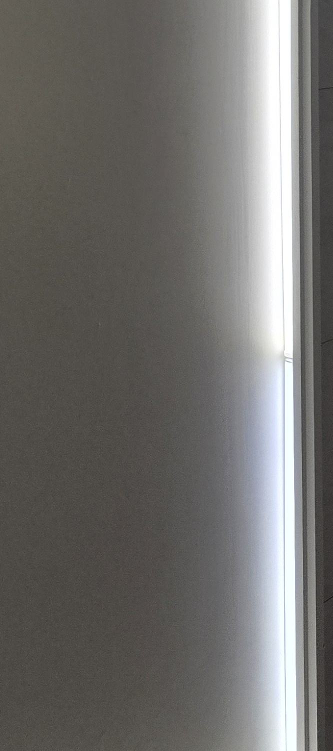 돌출 앞니 교정 이렇게 준비하세요 관련 이미지 19