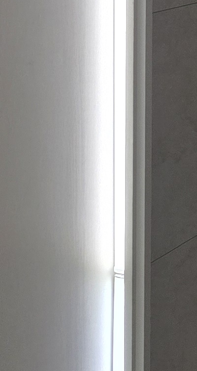 앞니 틀어짐 교정 조화롭게 마무리하려면 관련 이미지 34