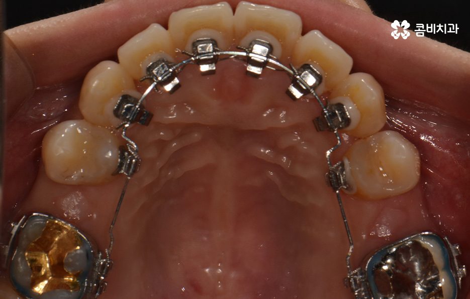 콤비교정 나에게 적합한지 판단하려면 관련 이미지 9