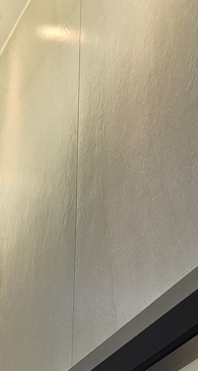 반대교합 치아교정 해결 가능할까 관련 이미지 22