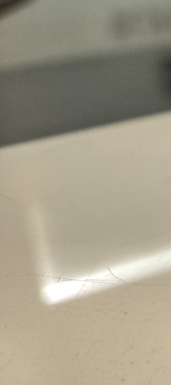 송곳니 덧니 발치 이럴때 해당되네요 관련 이미지 30