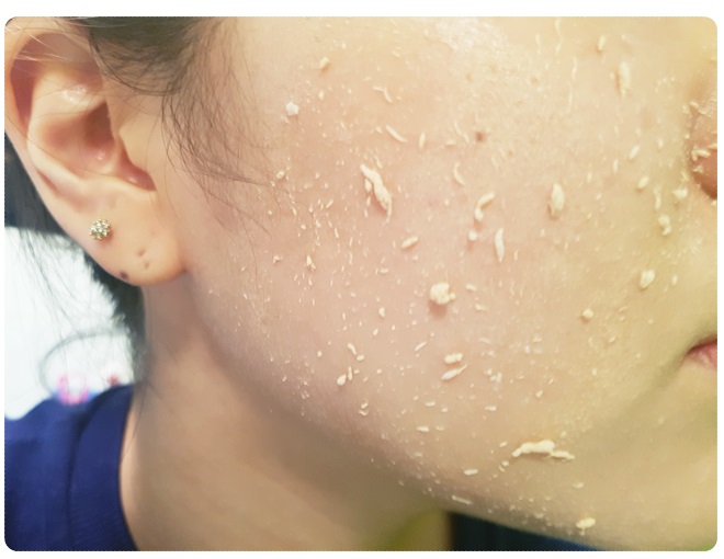 가을철피부관리 한방에 끝내기 관련 이미지 5