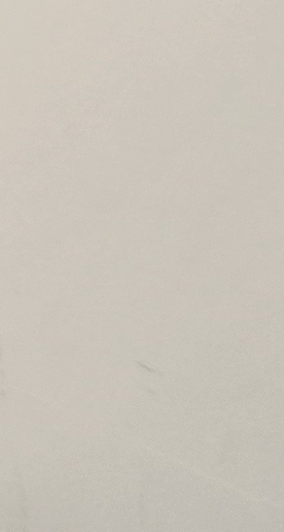 송곳니 크라운 티가 안나게 해결 가능한건가요 관련 이미지 46