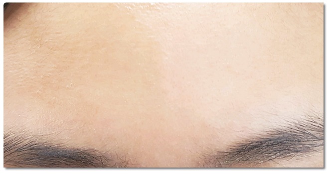 이마주름없애기 성공! 관련 이미지 7