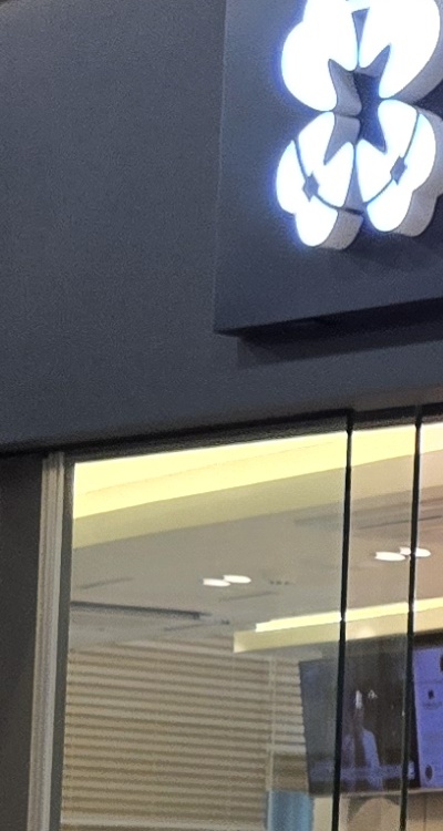 치아 발치 후 임플란트 언제부터 준비할까 관련 이미지 24