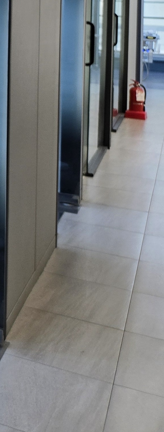 비발치 돌출입 교정 어떨때 적절할까 관련 이미지 35