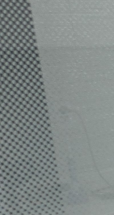 충치 검은점 나타났다면 이렇게 대처해요 관련 이미지 21