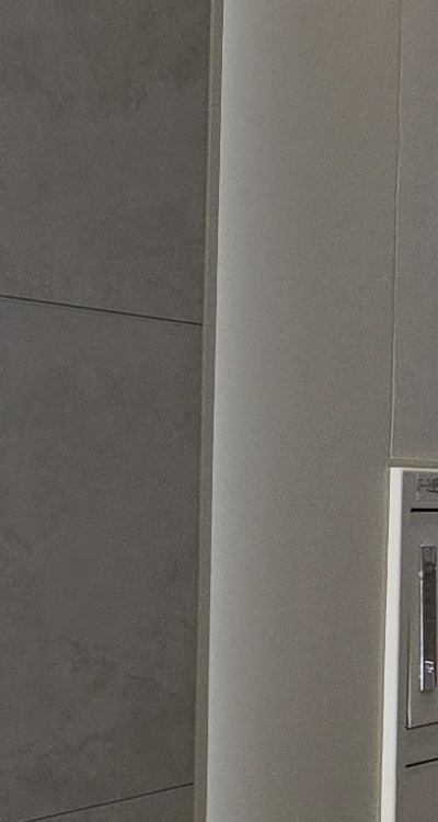 앞니 틀어짐 교정 조화롭게 마무리하려면 관련 이미지 25