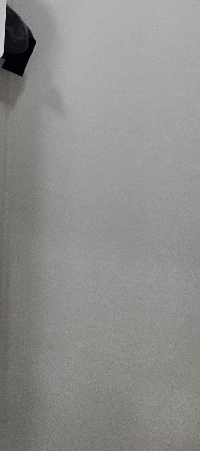 앞니 돌출 교정 기간 자세하게 따져보면 관련 이미지 39