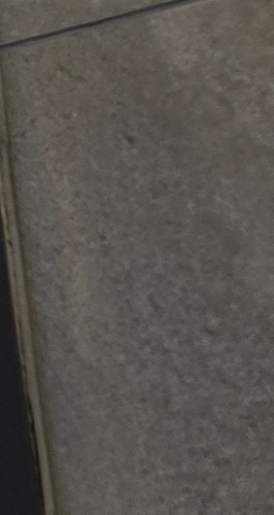 반대교합 치아교정 해결 가능할까 관련 이미지 36