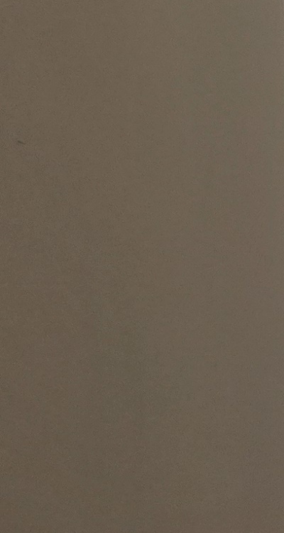 아말감 교체 레진 인레이 어떻게 대처하면 될까 관련 이미지 34