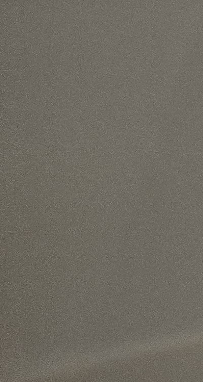 앞니 틀어짐 부분교정 얼마나 걸릴까 관련 이미지 31