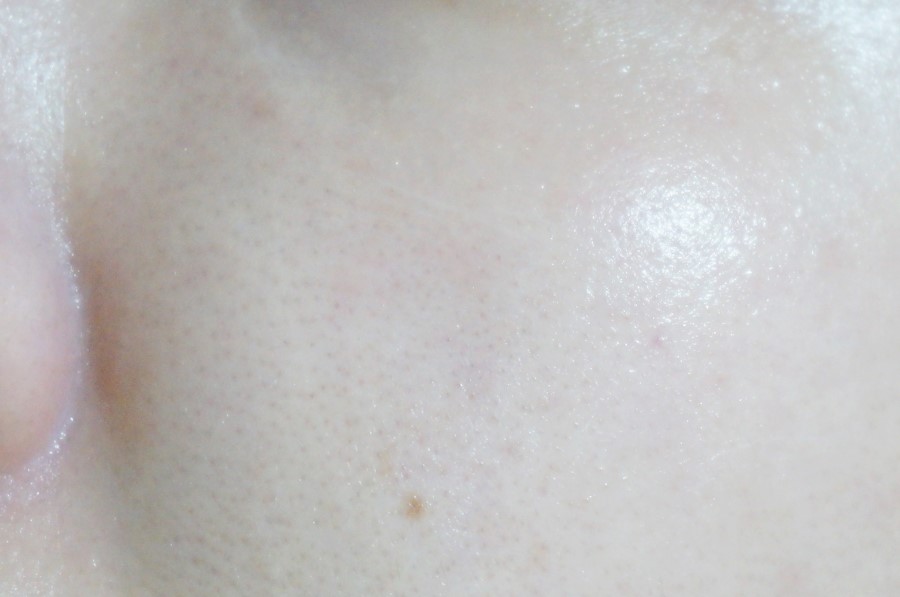 블랙헤드제거 간편하게 관리하세요~ 관련 이미지 9