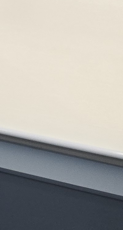 어금니 임플란트 안하면 후회하게 되는걸까 관련 이미지 31