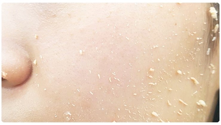 건조한피부관리 꿀템이당 관련 이미지 8