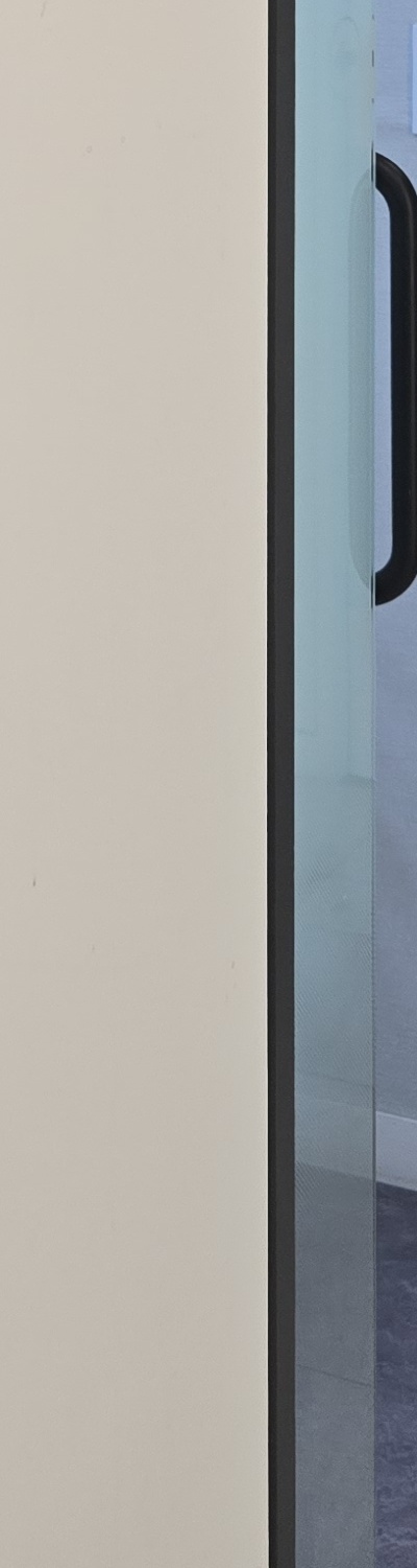 어금니 없으면 얼굴 발음에 어느정도나 안좋을까 관련 이미지 30