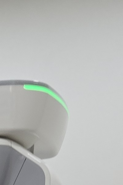 부정교합 교정 안하면 생기는 문제는 뭔가요 관련 이미지 26