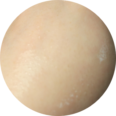 여드름피부화장품 꿀팁을 알려드리자면! 관련 이미지 10