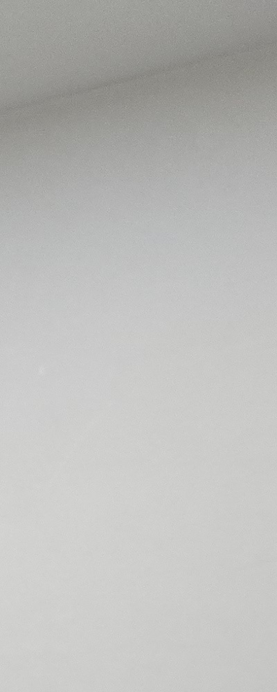 인레이 치료 후 신경치료 이유가 궁금하다면 관련 이미지 21