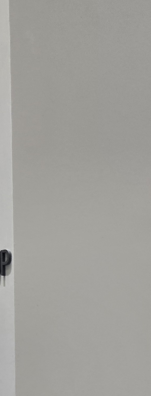 앞니 크라운 교체 깔끔하게 정리하려면 관련 이미지 31