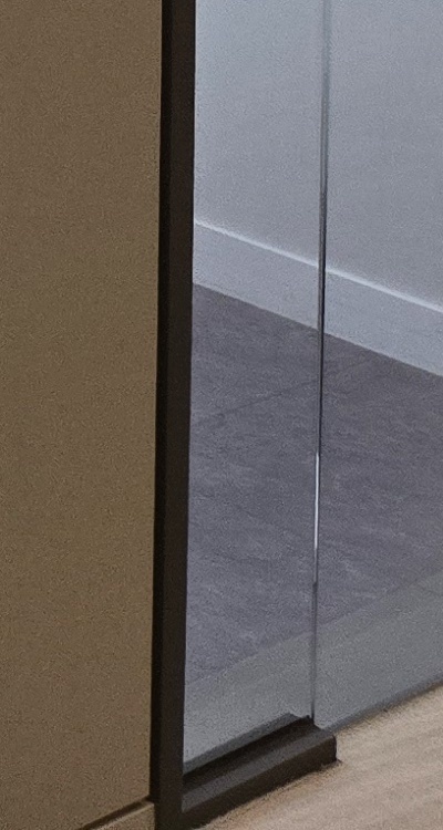 사랑니 발치 후 충치 치료 둘다 준비하려면 관련 이미지 49