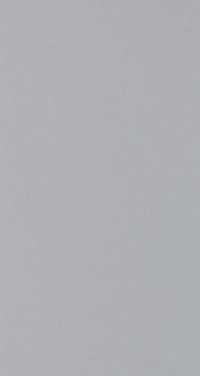 앞니 부분 교정 간단하니까 좋은건가요 관련 이미지 21