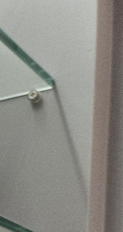 사랑니 주변 잇몸 통증 지금부터가 중요하니까 관련 이미지 21