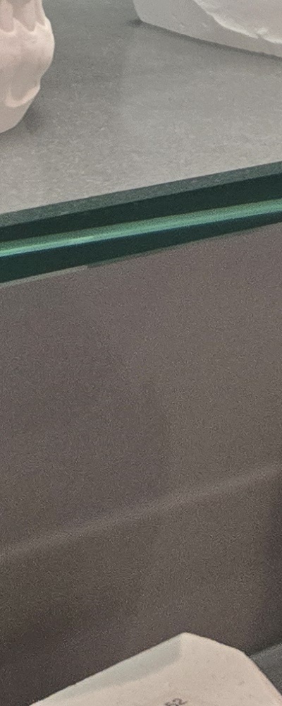 어르신 임플란트 지원 현명하게 활용하려면 관련 이미지 37