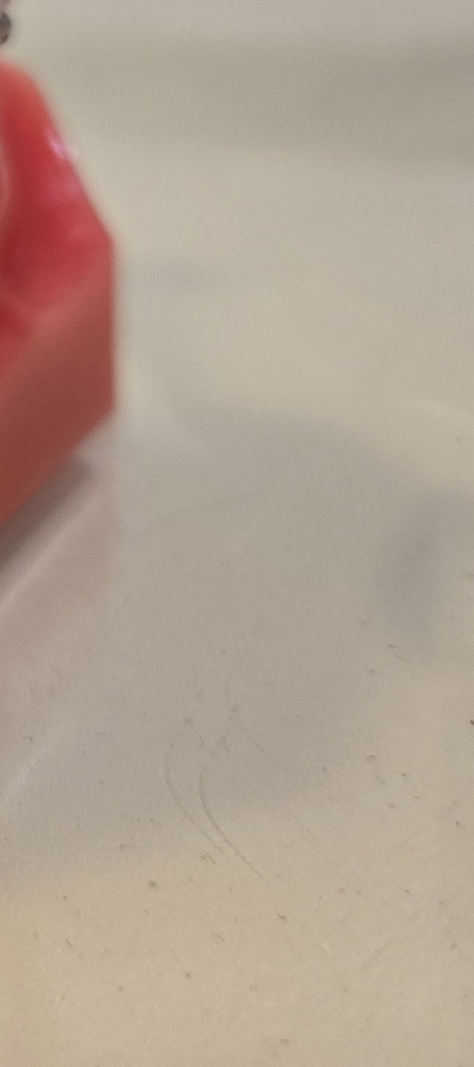 송곳니 덧니 발치 이럴때 해당되네요 관련 이미지 34