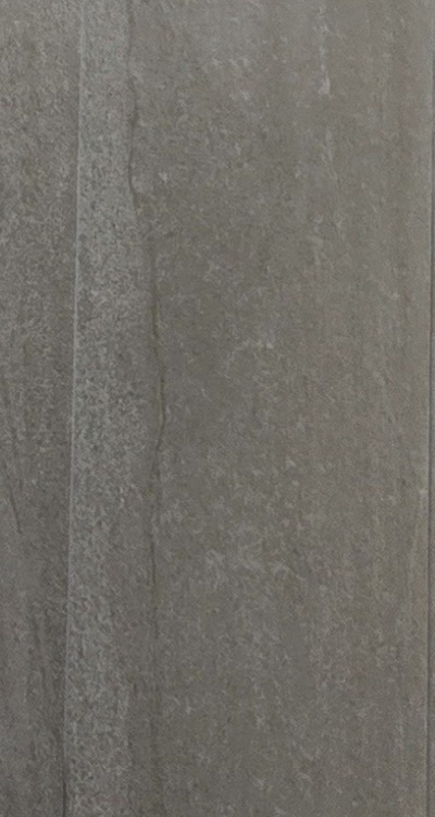 앞니 신경치료 크라운 까지 해야할 상황이라면 관련 이미지 47